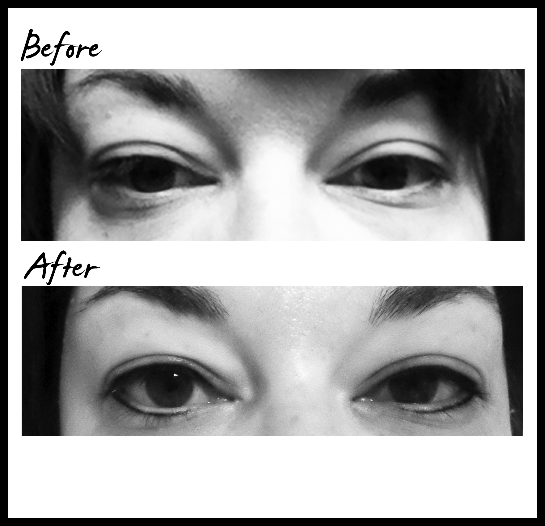 Permanent Eyeliner Before and After