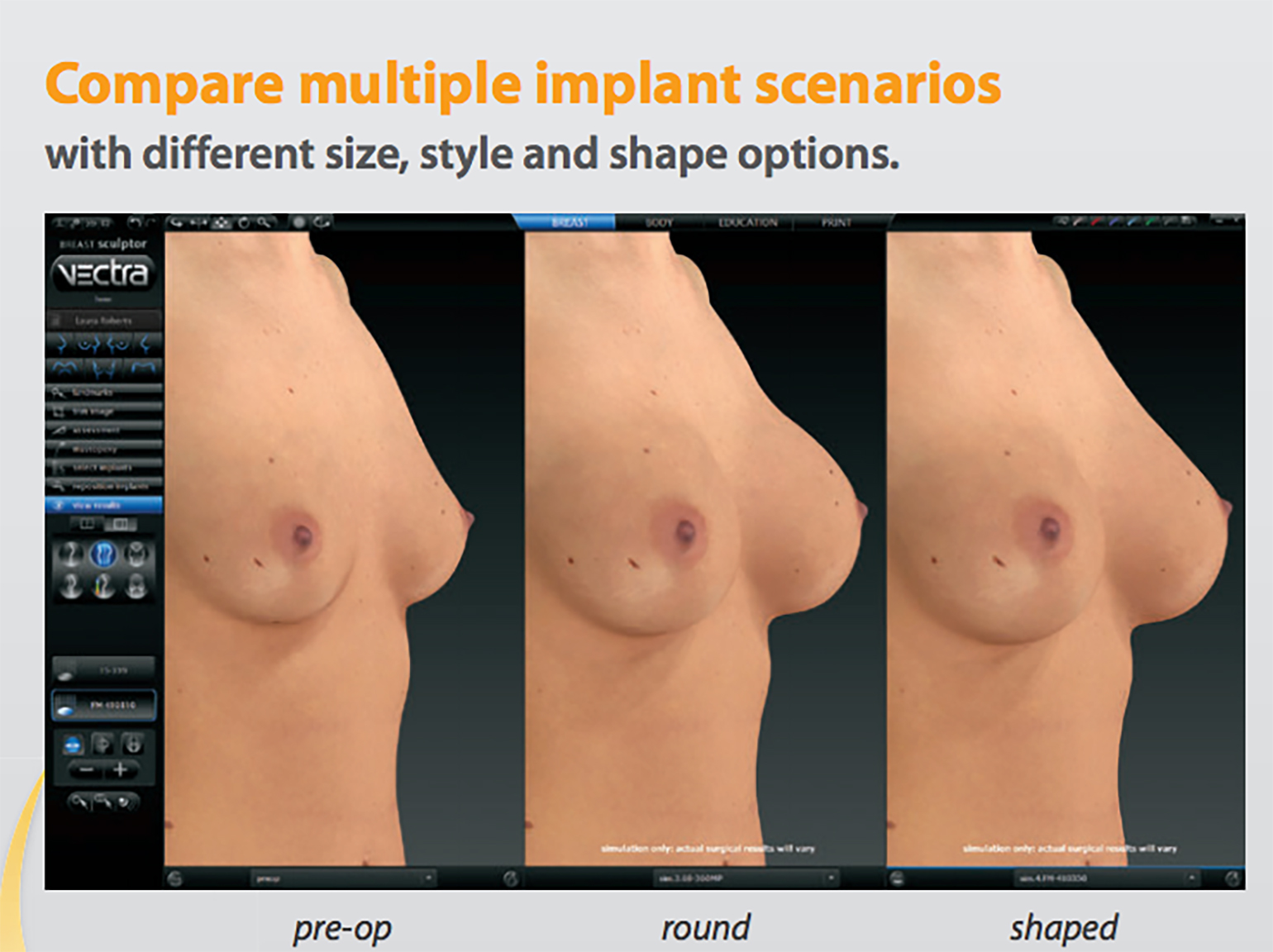 Before imaging, and two different types of implants