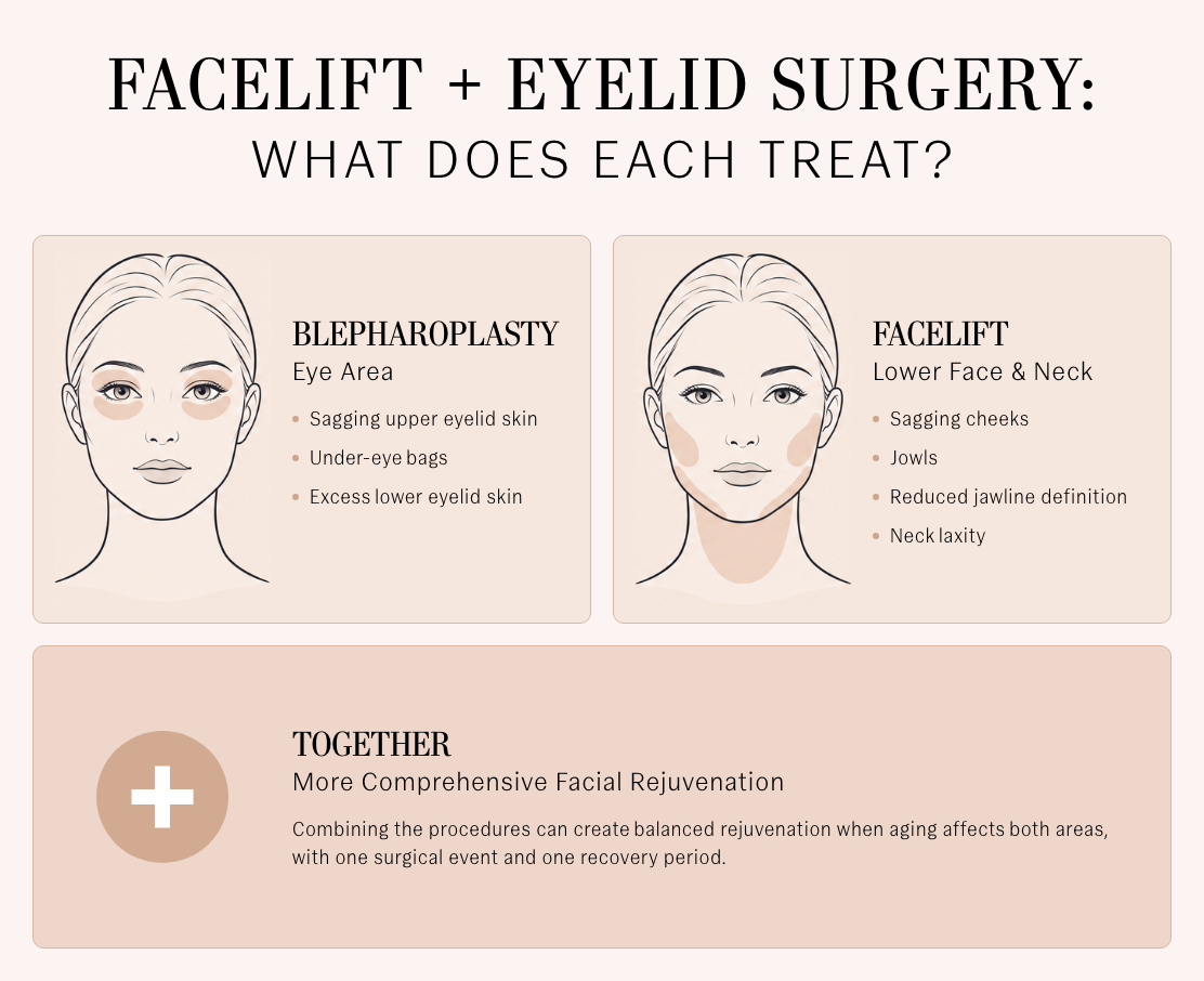 Illustrated comparison of blepharoplasty for sagging eyelid skin and under-eye bags versus a facelift for sagging cheeks, jowls, reduced jawline definition, and neck laxity. Combining both procedures can provide balanced facial rejuvenation with one surgery and recovery period.